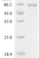 Parabacteroides distasonis Chaperonin GroEL (groEL) Recombinant Protein, N-10His/C-Myc - BioCrest Sci