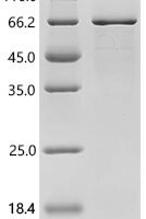 Human Nuclear receptor ROR-gamma(RORC) Recombinant Protein - BioCrest Sci