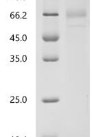 Pig Folate receptor 2 (fetal)(FOLR1) Recombinant Protein - BioCrest Sci