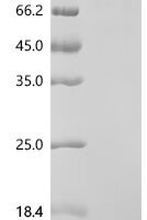 Macaca fascicularis Complement factor B (CFB) Recombinant Protein, C-hFc1 - BioCrest Sci