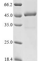 Human E3 ubiquitin-protein ligase TRIM63 (TRIM63) Recombinant Protein - BioCrest Sci