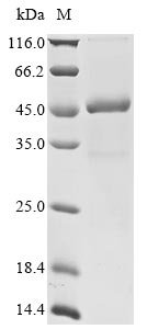 Human E3 ubiquitin-protein ligase TRIM63 (TRIM63) Recombinant Protein, Homo sapiens (Human), E.coli, N-terminal 10xHis-tagged and C-terminal Myc-tagged, 47.7 kDa, purity >≥ 85% as determined by SDS-PAGE.