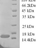 Human TRAF family member-associated NF-kappa-B activator (TANK), partial Recombinant Protein, N-His - BioCrest Sci