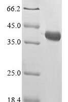 Bungarus multicinctus Alpha-bungarotoxin isoform A31 Recombinant Protein - BioCrest Sci