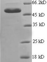 Human Endoplasmic reticulum resident protein 29 (ERP29), partial Recombinant Protein - BioCrest Sci