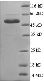 Human Endoplasmic reticulum resident protein 29 (ERP29), partial Recombinant Protein, Homo sapiens (Human), E.coli, N-terminal GST-tagged, 51.0 kDa, purity >≥ 90% as determined by SDS-PAGE.