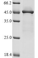 Cricetulus griseus Elongation factor 2 (EEF2), partial Recombinant Protein - BioCrest Sci