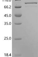 Cat Albumin (ALB) Recombinant Protein, N-His-SUMOstar - BioCrest Sci