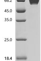 Human Leukocyte immunoglobulin-like receptor subfamily B member 1 (LILRB1), partial Recombinant Protein - BioCrest Sci