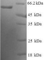 Human Endoplasmic reticulum resident protein 44 (ERP44) Recombinant Protein - BioCrest Sci