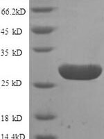 Human G-protein coupled receptor 161 (GPR161), partial Recombinant Protein - BioCrest Sci