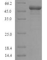 Human Glycogen synthase kinase-3 beta (GSK3B) Recombinant Protein, N-His - BioCrest Sci