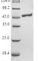 Human Telethonin (TCAP) Recombinant Protein - BioCrest Sci