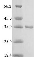Enterobacteria phage T6 Beta-glucosyl-HMC-alpha-glucosyl-transferase Recombinant Protein - BioCrest Sci