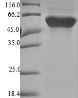 Human Fibrinogen beta chain (FGB), partial Recombinant Protein - BioCrest Sci