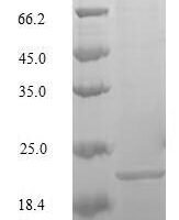 Mouse Transcription factor MafK (Mafk) Recombinant Protein, N-10His/C-Myc, aa 1–156, Baculovirus - BioCrest Sci