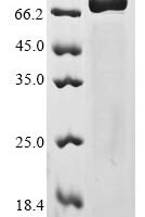 Human coronavirus NL63 Spike glycoprotein (S), partial Recombinant Protein, N-His-PDI - BioCrest Sci