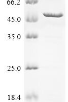 Human Melanoma-associated antigen 8 (MAGEA8) Recombinant Protein - BioCrest Sci