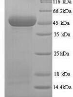 Human Protein Wnt-10a (WNT10A) Recombinant Protein, N-His - BioCrest Sci