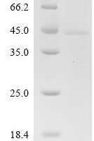 Human Butyrophilin-like protein 2 (BTNL2), partial Recombinant Protein, C-hFc1, aa 356–455 - BioCrest Sci