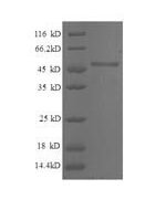 Human Breast cancer metastasis-suppressor 1 (BRMS1), partial Recombinant Protein - BioCrest Sci