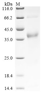 Macaca mulatta Neurofilament light chain (NEFL) Recombinant Protein, Macaca mulatta (Rhesus macaque), Yeast, C-terminal 6xHis-tagged, 62.9 kDa, purity >≥ 90% as determined by SDS-PAGE.