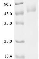 Mouse Focal adhesion kinase 1 (Ptk2), partial Recombinant Protein, N-His - BioCrest Sci