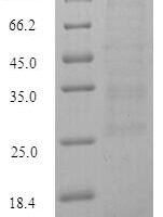 Danio rerio Metallothionein-2 (mt2) Recombinant Protein - BioCrest Sci