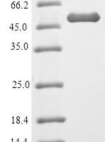 Mouse Heterogeneous nuclear ribonucleoproteins A2/B1 (Hnrnpa2b1) Recombinant Protein, N-10His-SUMO/C-Myc - BioCrest Sci