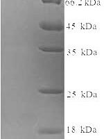 Human Probable global transcription activator SNF2L2 (SMARCA2), partial Recombinant Protein, N-His-SUMO - BioCrest Sci