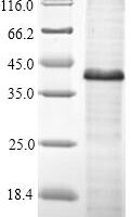 Human Protein Wnt-5a (WNT5A) Recombinant Protein, N-10His/C-Myc - BioCrest Sci