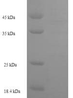 Human Leucine-rich repeat neuronal protein 1 (LRRN1), partial Recombinant Protein - BioCrest Sci