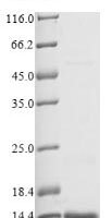 Naja mossambica Cytotoxin 5 Recombinant Protein - BioCrest Sci