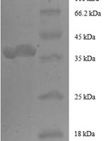 Human Peptidyl-prolyl cis-trans isomerase FKBP1A (FKBP1A), partial Recombinant Protein - BioCrest Sci