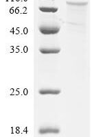 Human Transcription factor Sp1 (SP1) Recombinant Protein - BioCrest Sci
