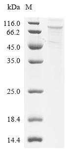 Human Transcription factor Sp1 (SP1) Recombinant Protein, Homo sapiens (Human), E.coli, C-terminal 6xHis-tagged, 87.5 kDa, purity >≥ 85% as determined by SDS-PAGE.