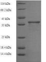 Human Zinc finger protein 26 (ZNF26), partial Recombinant Protein - BioCrest Sci