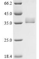 Alternaria alternata Probable NADP-dependent mannitol dehydrogenase Recombinant Protein - BioCrest Sci