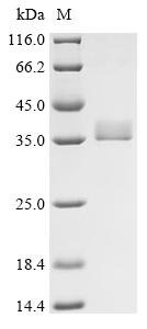 Alternaria alternata Probable NADP-dependent mannitol dehydrogenase Recombinant Protein, Alternaria alternata (Alternaria rot fungus) (Torula alternata), E.coli, N-terminal 10xHis-tagged, 34.8 kDa, purity >≥ 95% as determined by SDS-PAGE.