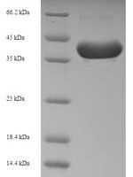 Human Interleukin-3 (IL3) Recombinant Protein - BioCrest Sci