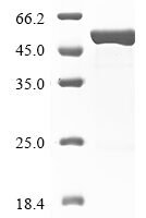 Human Glial fibrillary acidic protein (GFAP) Recombinant Protein - BioCrest Sci