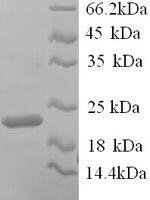 Mouse Integrin alpha-L (Itgal), partial Recombinant Protein, N-His, aa 153–325, Yeast - BioCrest Sci