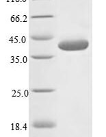 Measles virus Hemagglutinin glycoprotein (H), partial Recombinant Protein - BioCrest Sci