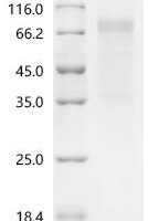 Human Sodium/potassium-transporting ATPase subunit alpha-1 (ATP1A1), partial Recombinant Protein, N-hFc1 - BioCrest Sci