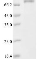 Human Semenogelin-2 (SEMG2) Recombinant Protein, C-10His - BioCrest Sci