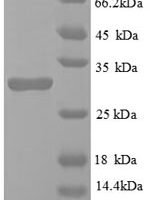 Mouse Egl nine homolog 3 protein (Egln3) Recombinant Protein - BioCrest Sci