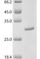 Human Chymotrypsinogen B2 (CTRB2) Recombinant Protein, C-10His - BioCrest Sci