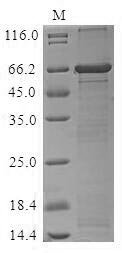 Nostoc sp. Alr2278 protein (alr2278) Recombinant Protein, N-MBP/C-His, Nostoc sp. (strain PCC 7120 / SAG 25.82 / UTEX 2576), Baculovirus, N-terminal MBP-tagged and C-terminal 6xHis-tagged, 65.2 kDa, purity >≥ 85% as determined by SDS-PAGE.