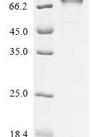 Human Butyrophilin-like protein 2 (BTNL2), partial Recombinant Protein, C-hFc1, aa 24–383 & 400–457 - BioCrest Sci