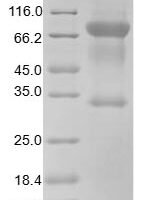 Human T-lymphocyte activation antigen CD80 (CD80), partial Recombinant Protein - BioCrest Sci